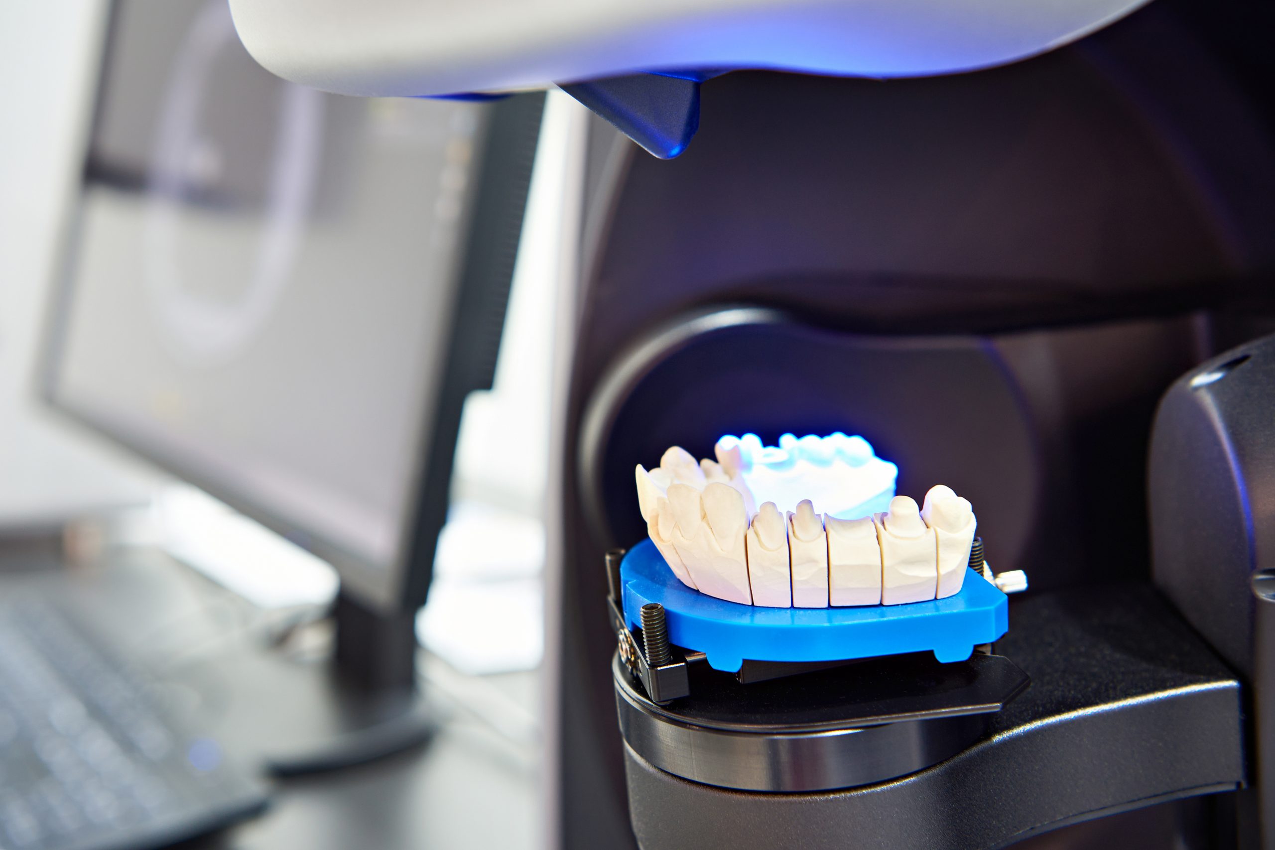 Beautiful,Ceramic,Teeth,Made,In,The,Dentist,'s,Office,On