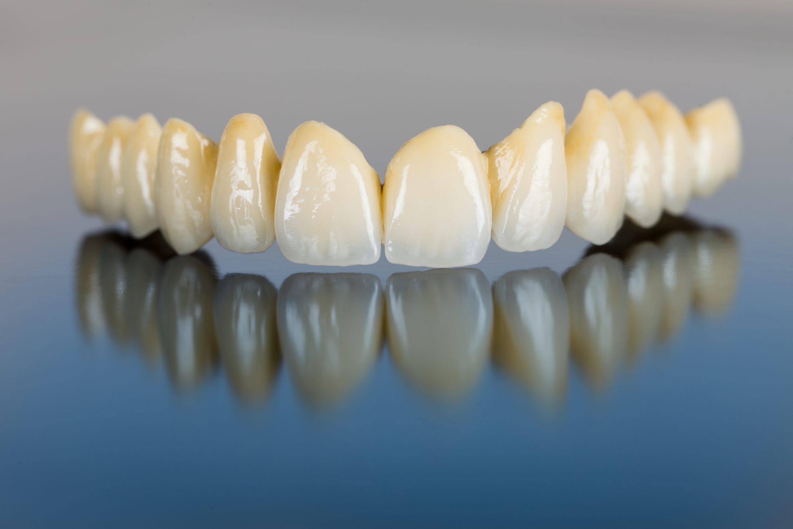 Beautiful,Ceramic,Teeth,Made,In,The,Dentist,'s,Office,On